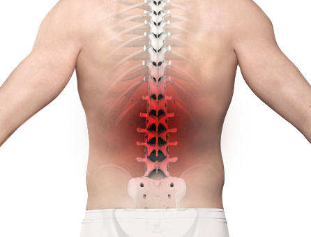 Back Pain