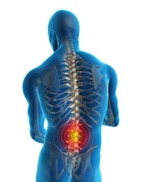 Low Back Pain